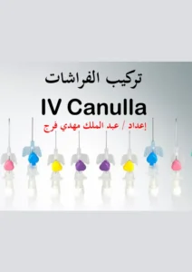 غلاف كتاب تركيب الكانيولا pdf