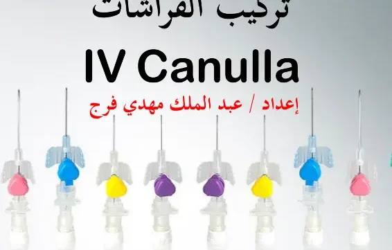 غلاف كتاب تركيب الكانيولا pdf