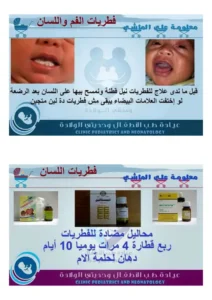 الأدوية الشائعة للأطفال والرضع pdf