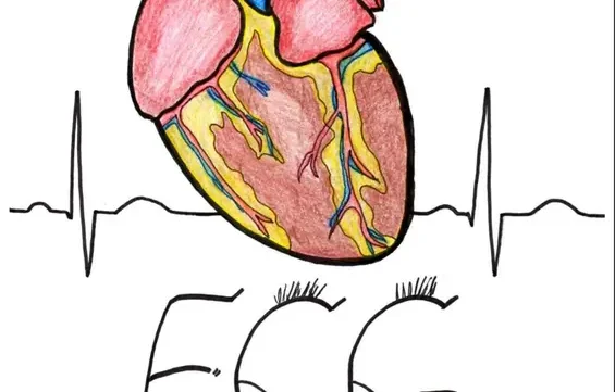 ملخص DocToon ECG pdf